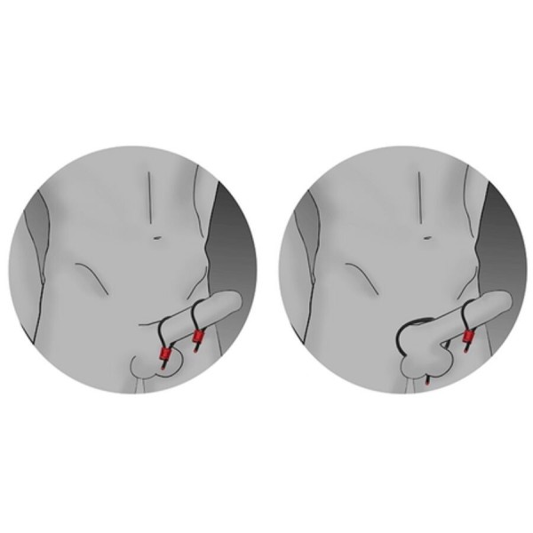 ELECTRASTIM - PRESTIGE ELECTRA LOOPS ANNEAUX PÉNIENS RÉGLABLES ROUGES ELECTRASTIM