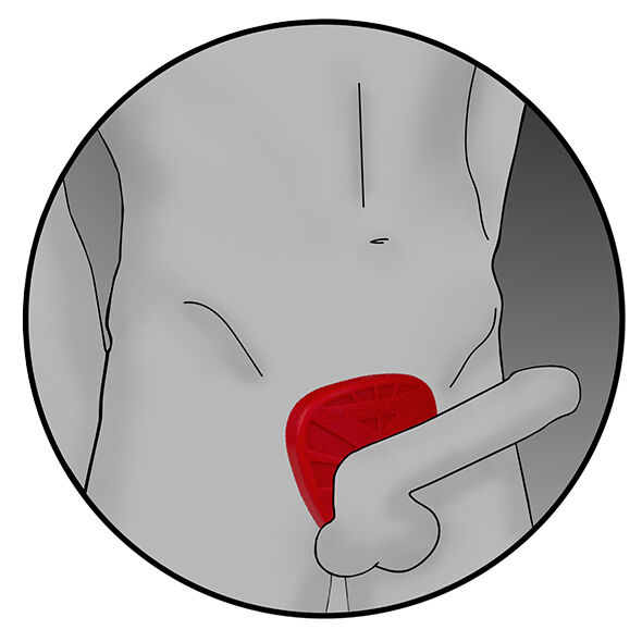 Protège-bite électro en silicone Fusion Viper — ELECTRASTIM